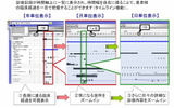 「Future Clinic 21ワープ」では電子カルテのタイムテーブル機能により臨床経過が一目瞭然となるの画像