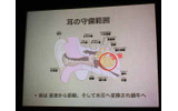 人間の耳の概要の画像