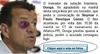 「ブラジル代表ドゥンガ監督、ファンから暴行!」……というメールに要注意、マカフィーが警告