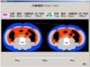 日立、体重と腹囲から腹部の疑似断層画像を表示するメタボ対策支援技術