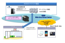 KDDIと米テラリコン、クラウド型「リアルタイム3D医用画像ソリューション」提供開始 画像