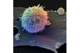 注目の免疫細胞「Tレグ」……NHKスペシャルでアレルギー研究を紹介 画像