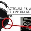 右耳部の印の画像