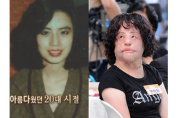 美女がなぜ“扇風機おばさん”に？死去の秘話が明かされる…違法整形、顔に工業用シリコンを注入