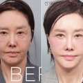 限界ギリギリまで整形、60代とは思えないビジュアルに！韓国ベテラン女優の潔すぎる告白が話題