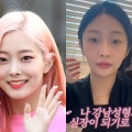 ほかのメンバーは感動の復帰も…“SEVENTEENの妹グループ”出身の元アイドル、美容外科勤務を告白