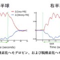 小学生、英単語を処理する脳活動の基本パターンを解明 神経活動に伴う酸素化ヘモグロビン、および脱酸素化ヘモグロビンの相対的変化