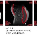 「日常の歩行（よい姿勢で歩幅を広く、速く)をサポートする」提案