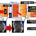 ヒップの構造と加齢変化する要因