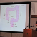 松生クリニック院長の松生恒夫氏による講演
