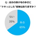 自分の抜け毛の多さに“ドキっとした”経験はありますか？