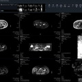 専用の「検査画像ビューア」で検査画像を高速表示。過去の検査画像との比較も容易だ（画像はプレスリリースより）