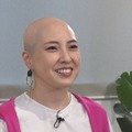 抜毛症を告白する土屋さん（C）フジテレビ