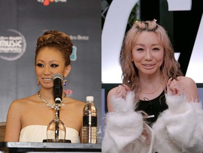 倖田來未（43）の第2子妊娠が韓国でも注目　“あの一言”とセットで「高齢出産とは何か」を問う報じられ方も