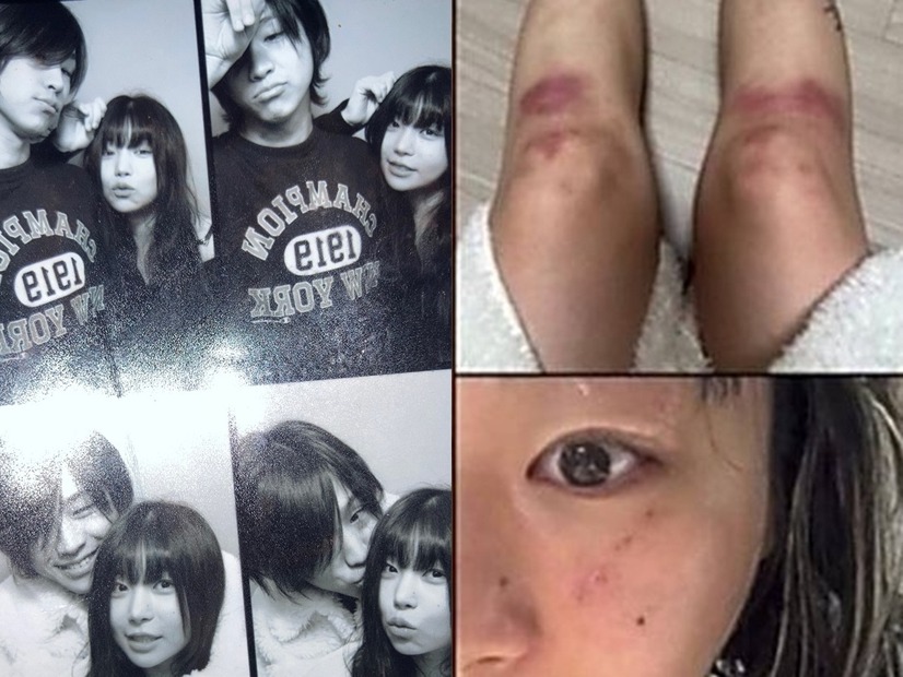 “デートDV被害”を暴露→立場を翻した韓国女性ラッパー、加害者と指名した元恋人と復縁を示唆