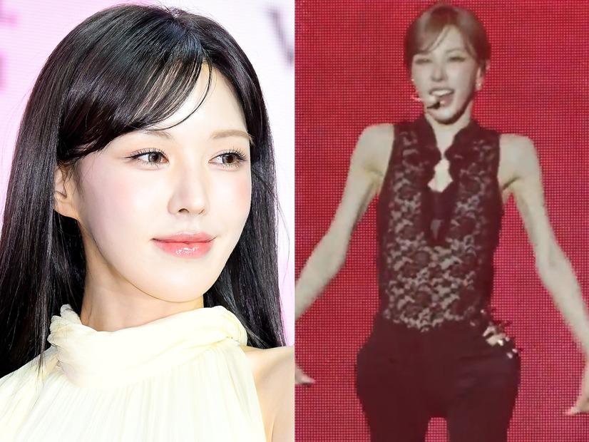 あまりにも痩せた姿に「骨のよう」、摂食障害を疑う声まで…Red Velvet・ウェンディに心配相次ぐ