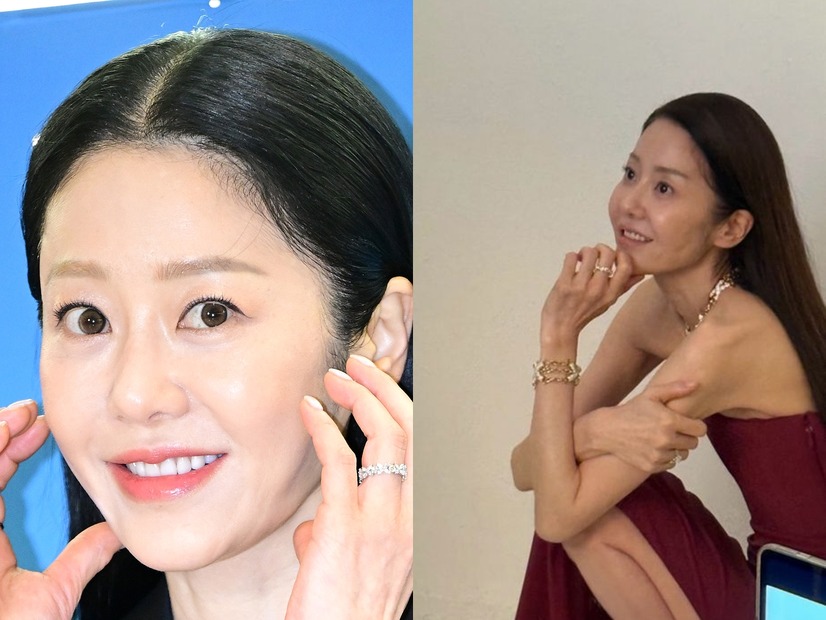 「撮影現場で何度も倒れた」過去も…韓国女優、骨が浮き出るほどやせ細った姿に心配の声