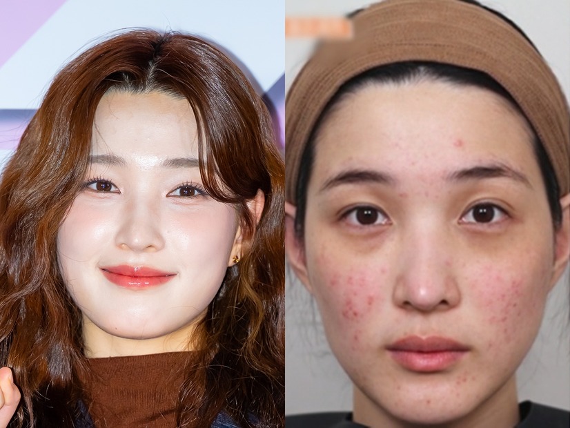 「育ててるのは元夫でしょ」元韓国アイドル、“育児で”ボロボロになった肌公開も視聴者は不快感