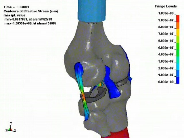 人体モデル開発例 膝の曲げ試験