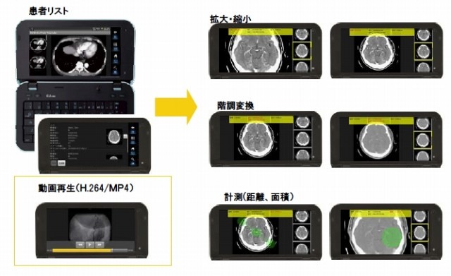 SmartMIMAS画面例