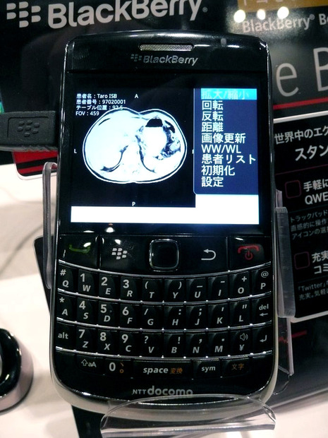 Dicomサーバーに蓄積されているCT画像や超音波診断などの画像データを、BlackBerryに読み込んで表示させることで一次診断に利用