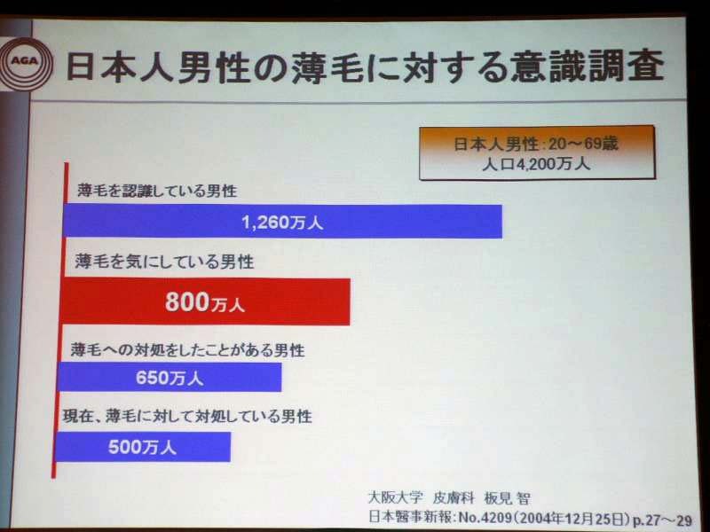 	日本人男性の半数近くが、薄毛を気にしたり対策をほどこしている現状