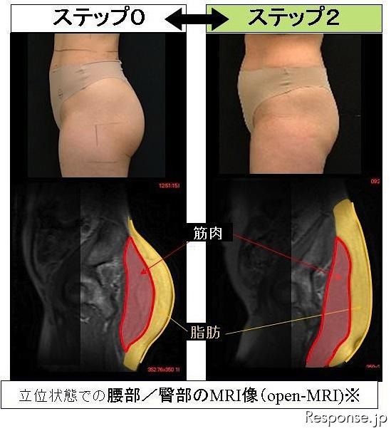 ヒップの形が変化するのは、単に脂肪がついてくるだけでなく、「内部がゆるむ」から