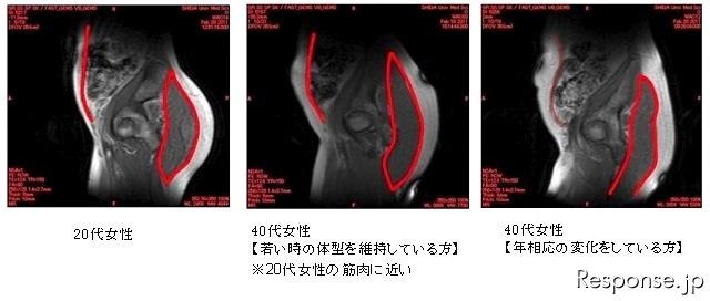 「日常の歩行（よい姿勢で歩幅を広く、速く)をサポートする」提案