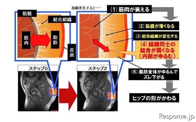 ヒップの構造と加齢変化する要因