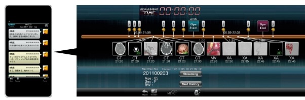 遠隔画像診断治療補助システム「i-Stroke」