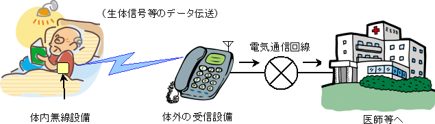 　総務省は21日、体内植込型医療用遠隔監視システムを実用化するための特定省電力無線局制度の整備に必要な技術的条件案「400MHzメガヘルツ帯を利用した体内無線設備の利用形態拡大に向けた技術的条件案」を作成し、12月21日午後5時までの間、広く意見を公募する。