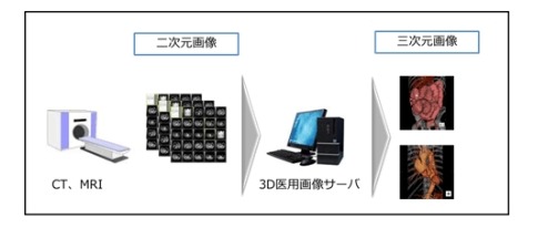 3D医用画像生成イメージ