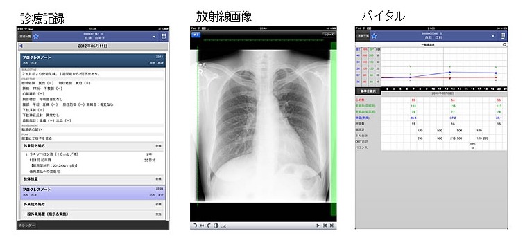 モバイル端末で閲覧可能な診療情報の一部（例） 