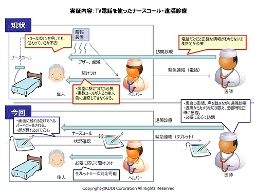 TV電話を使ったナースコール・遠隔診療