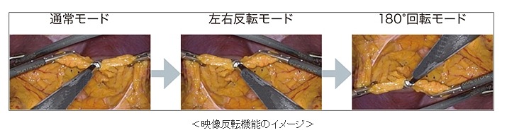 映像反転機能のイメージ