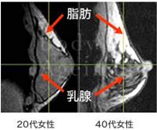 立位状態でのバスト内部