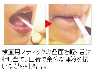ミュータンス菌検査キット「デントカルトSM」の検査方法その1