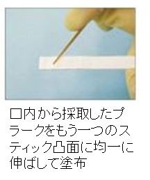 ミュータンス菌検査キット「デントカルトSM」の検査方法その2