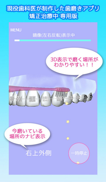 矯正歯磨き貯金
