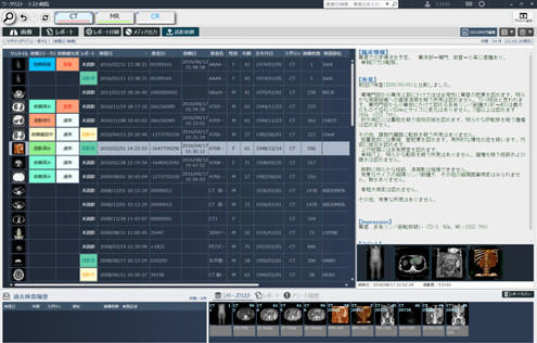 「医療用画像管理システム（PACS）」にはPCやスマホなどマルチデバイスでのアクセスが可能。検査一覧は「検査ワークリスト」画面上で参照できる（画像はプレスリリースより）