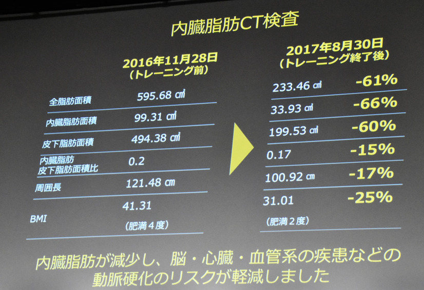 松村邦洋のライザップ前と後のCT検査結果