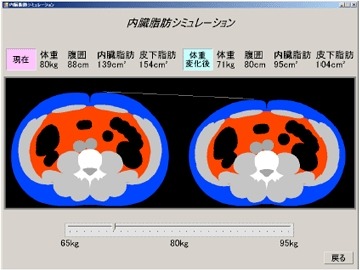 内臓脂肪シミュレーションの例：CTのようでCTでない