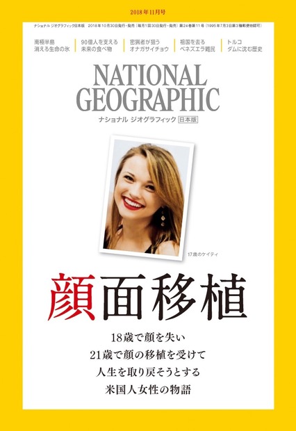 米国人女性の顔面移植を特集ーー10月30日発売『ナショナル ジオグラフィック日本版2018年11月号』