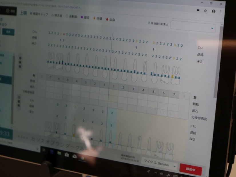 歯科検診のカルテ：音声認識により自動的に作成される