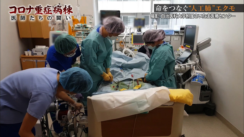 フジ「コロナ重症病棟」２・人工肺「エクモ」の回路交換作業（C）フジテレビ