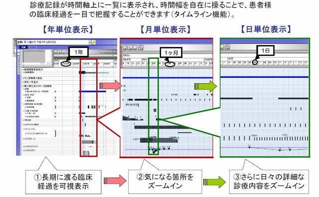 「Future Clinic 21ワープ」では電子カルテのタイムテーブル機能により臨床経過が一目瞭然となる