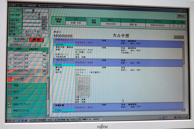 参照ツール「カルテ歴」の例
