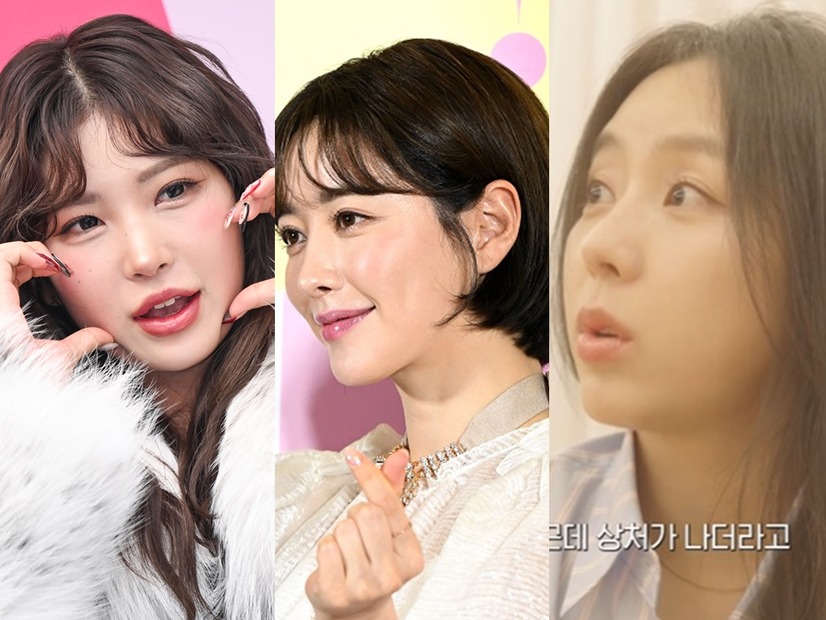 「鼻先を少し上げた」と整形手術を明かす元K-POPアイドル…“顔は全部”から“胸の手術”まで告白する韓国スターたち