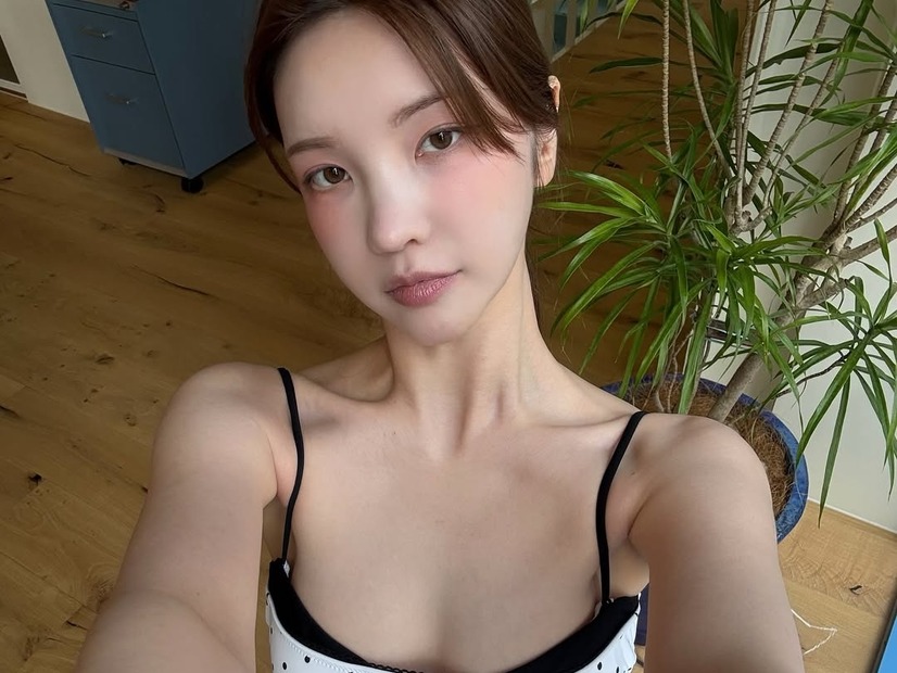 “パク・ソジュンとの熱愛説”で一躍時の人に、韓国美女ユーチューバーが流行りの歯科施術を報告