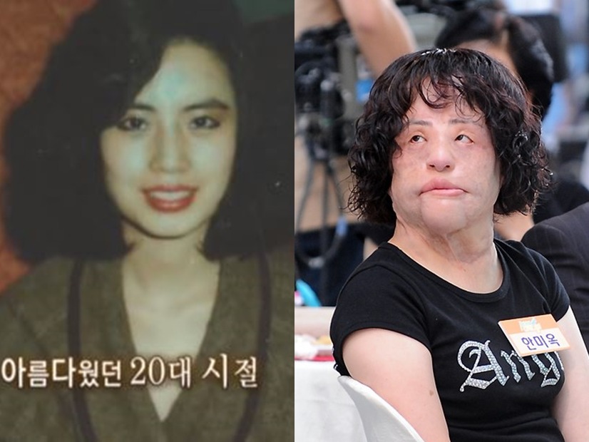 整形手術の副作用で苦しんだ「扇風機おばさん」、7周忌　死因は未だに不明のまま